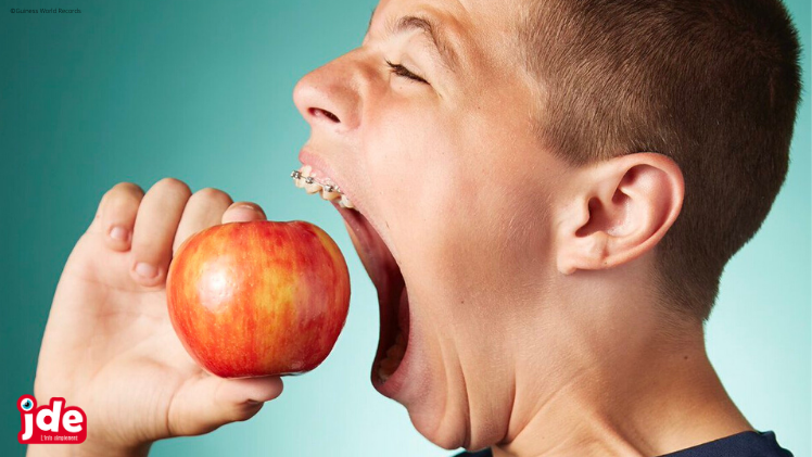 Isaac A Une Grande Bouche Actu News Gulli